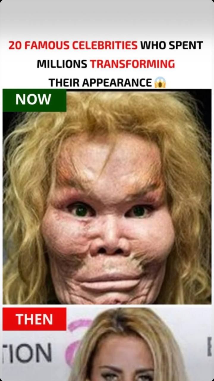 "Hollywood's Pricey Makeovers: Celebs Who Spent a Fortune to Redefine Beauty 😱"