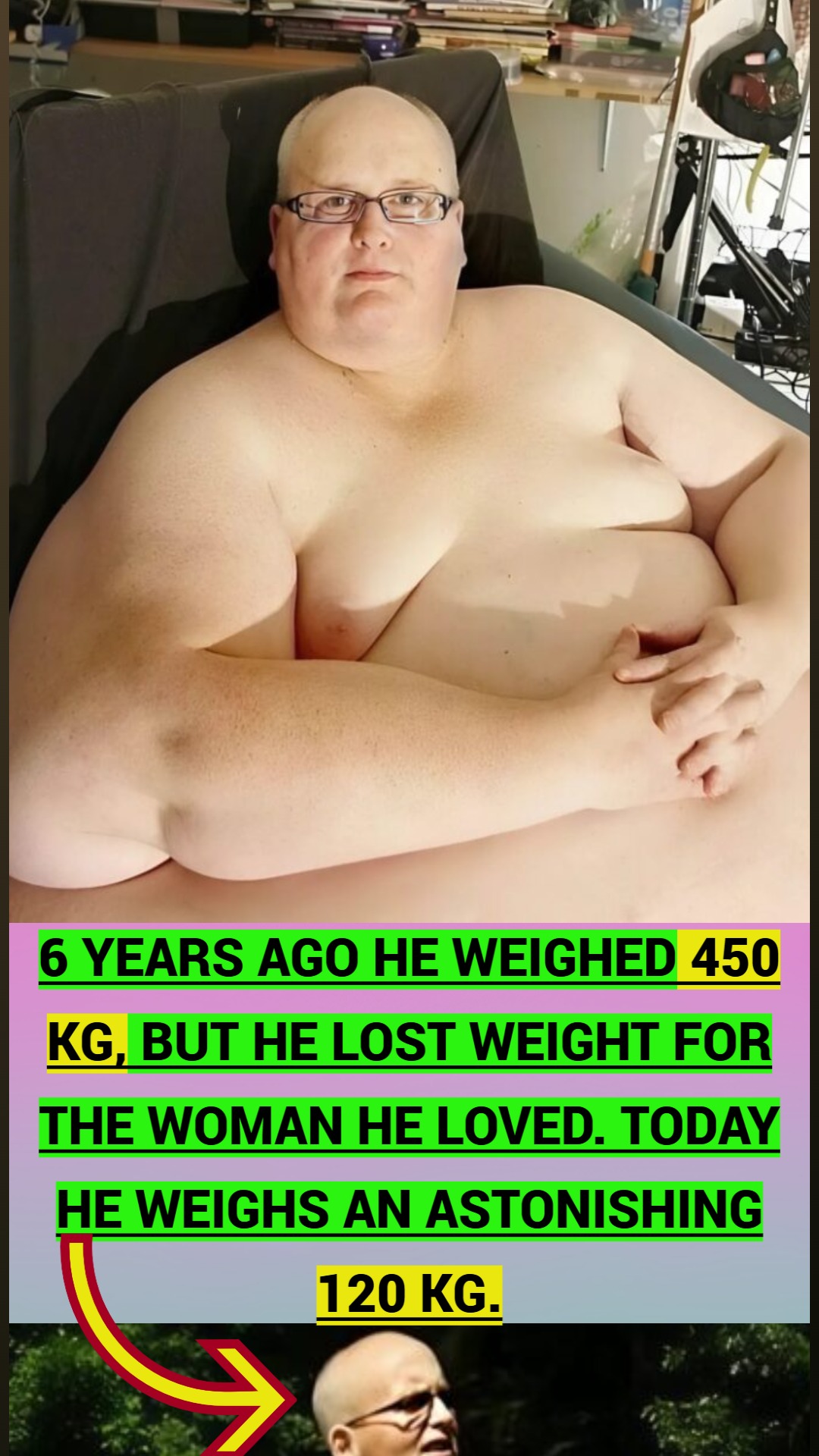 6 years ago he weighed 450 kg, but he lost weight for the woman he loved. Today he weighs an astonishing 120 kg.